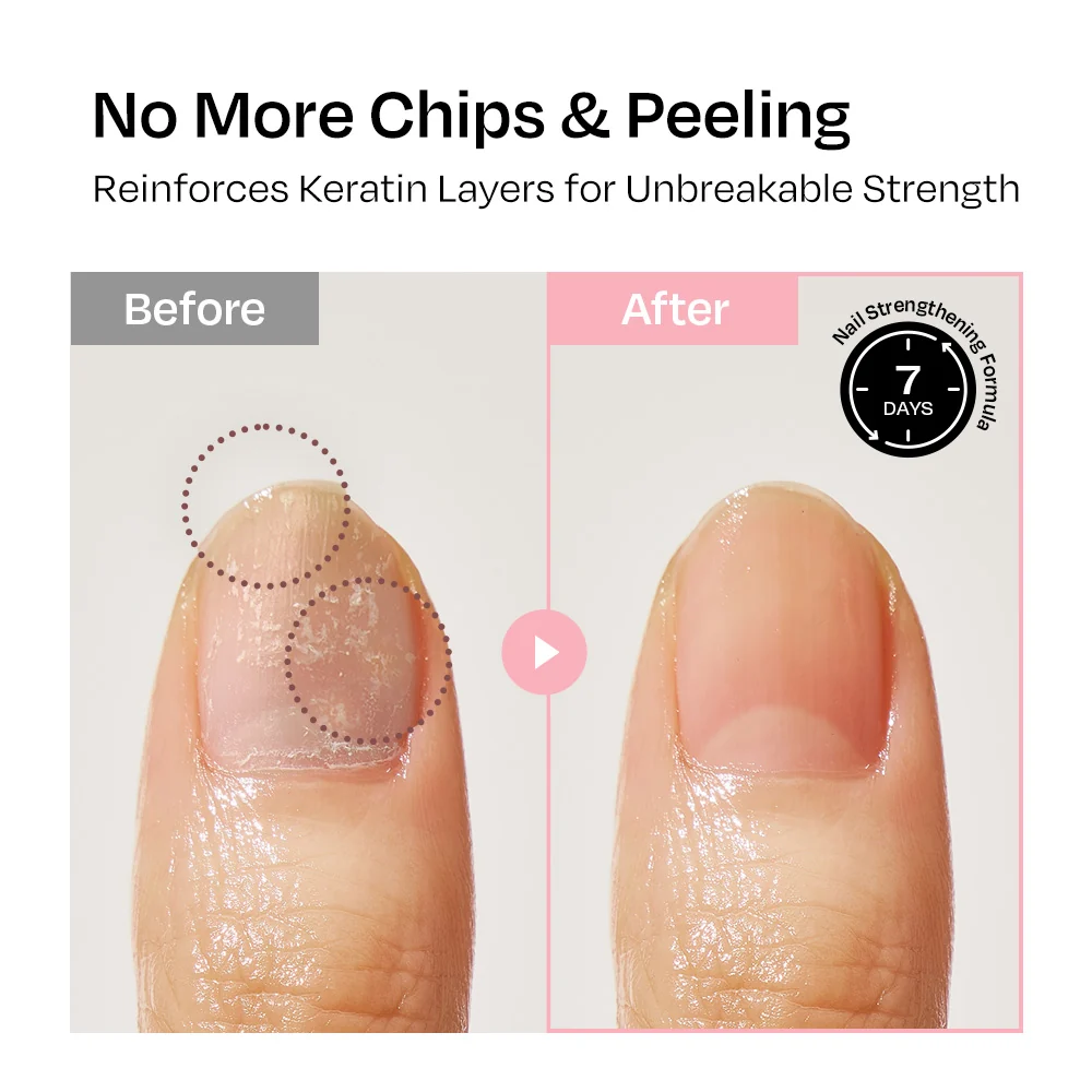[Cherry Blossom] Nail Strengthener - Image 9