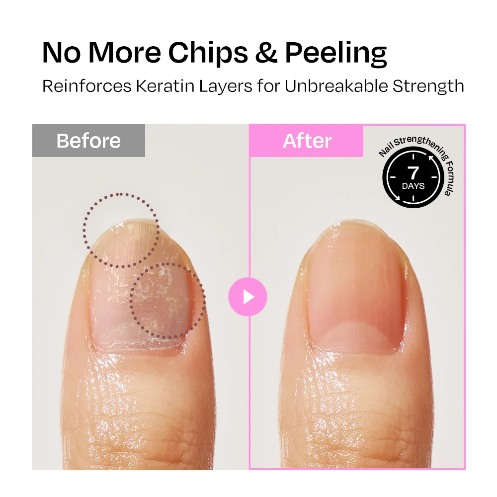 [Plum] Nail Strengthener - Image 9