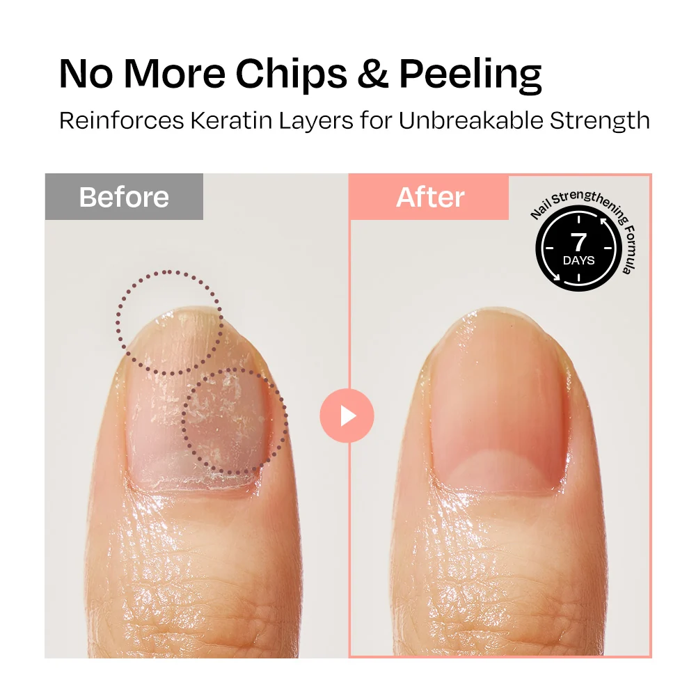 [Rosehip] Nail Strengthener - Image 9