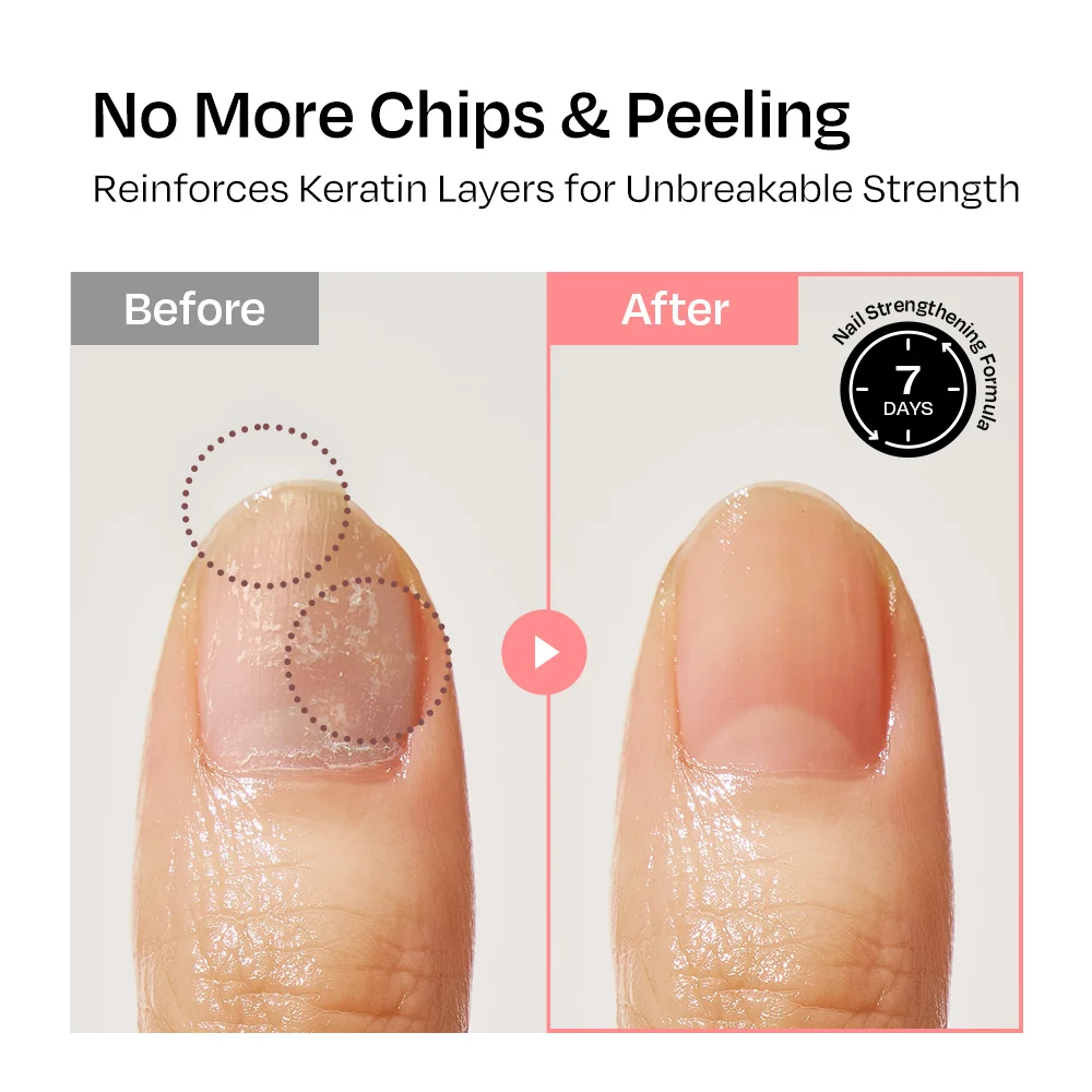 [Strawberry] Nail Strengthener - Image 9