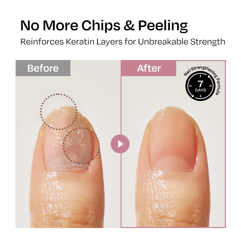 [Taro] Nail Strengthener - Image 9